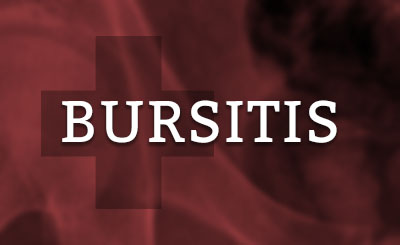 Bursitis Doctor Milwaukee