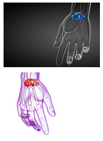 Carpal Tunnel Release Surgery