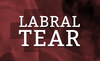 Labral Tear Shoulder Doctor
