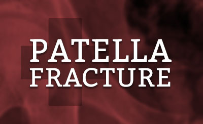 Patella Knee Cap Fracture