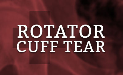 Rotator Cuff Tear