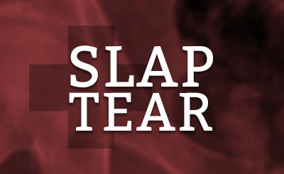 Slap Tear Doctor