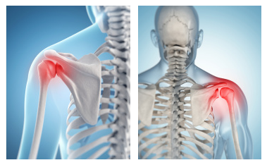 Superior Labral Repair (Shoulder)