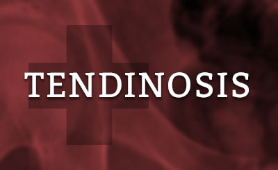 Tendinosis Doctor Wisconsin
